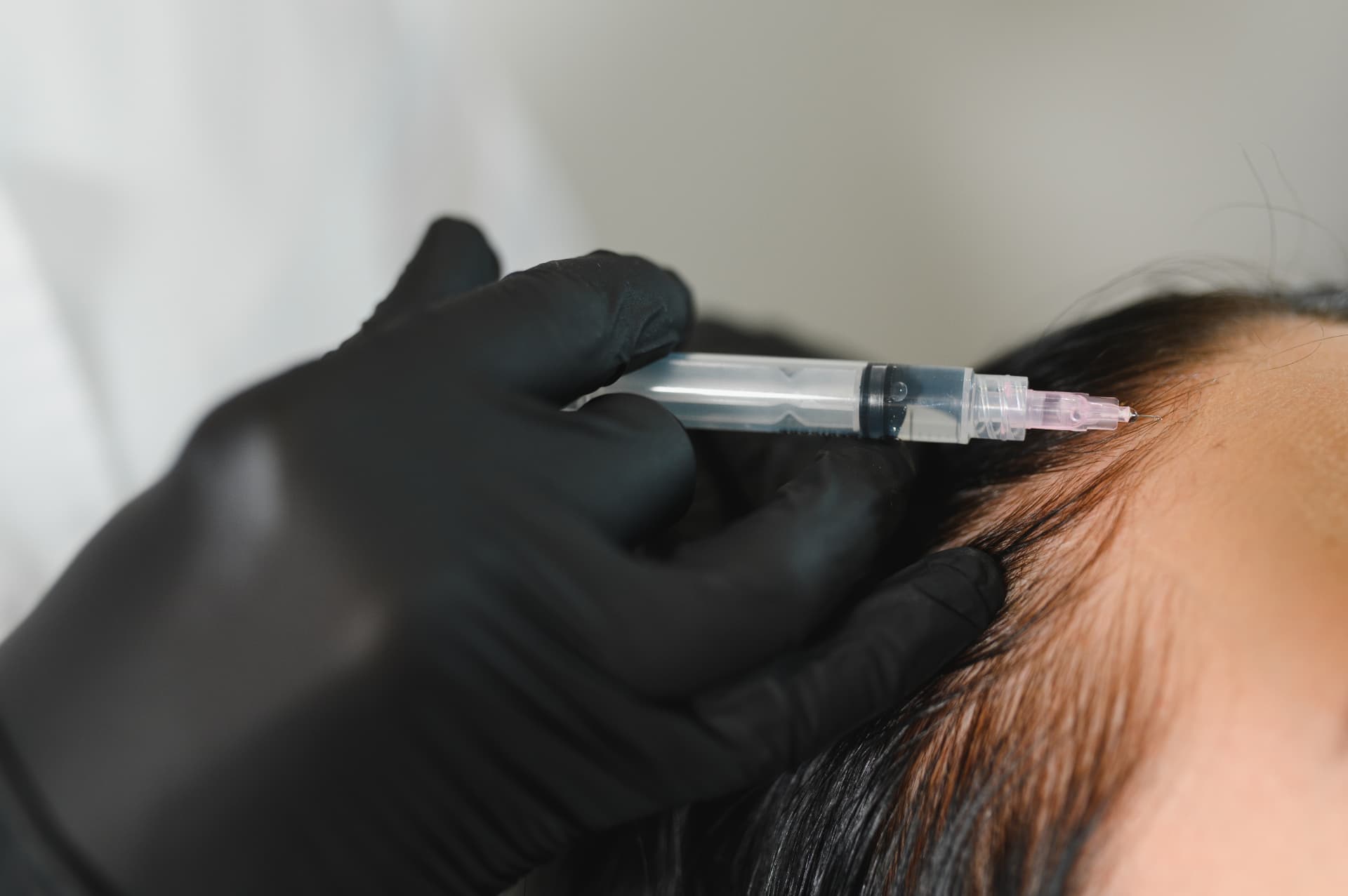 Gloved practitioner administering a vitamin injection into a client's scalp at the Workington clinic