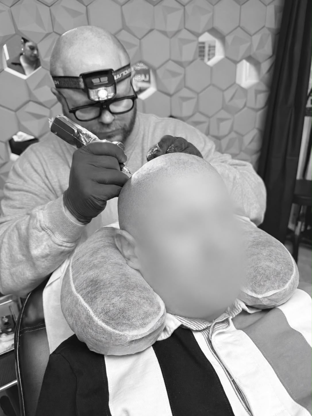 Brett applying scalp micropigmentation to a client at the Workington clinic